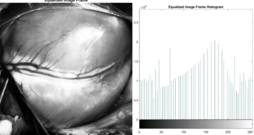 Figure 2: Histogram Equalization Results – Original Image and Respective Histogram (top)  Equalized Image and Histogram (bottom) 