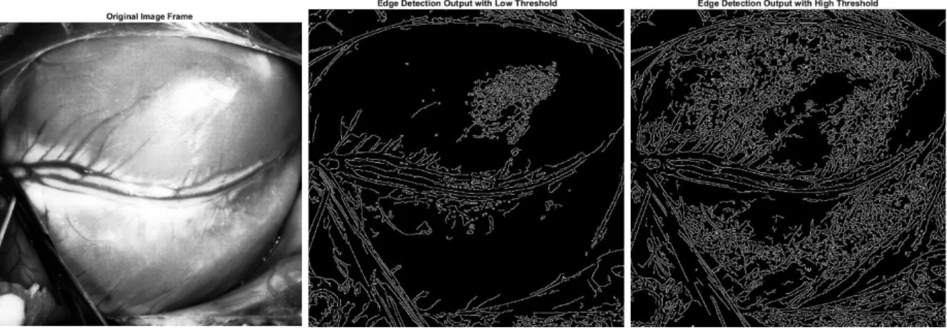 Figure 4: Original Image (left) with Low Threshold Edge Detection (middle) and High  Threshold Edge Detection (right)  