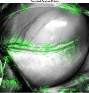 Figure 13: Fast-Hessian Detection of Feature Points in an Image 