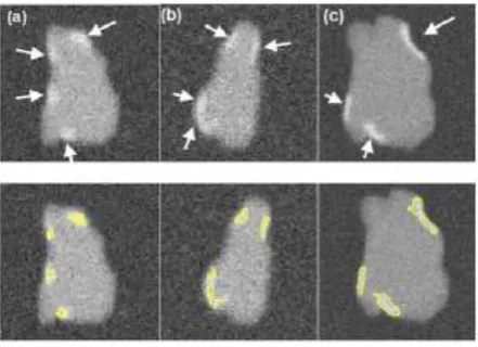 FIGURE 5. row). In a separate experiment, the SNR was varied from 4 to 16 along with the SC-BP contrast indicated by the arrows (Top row)
