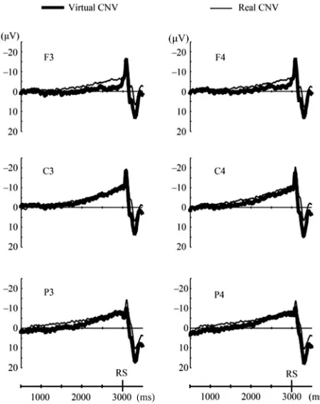 Figure 1. Grand averaged waveforms of CNV in the warned reaction-time task, and SPN and RP in the time estimation task