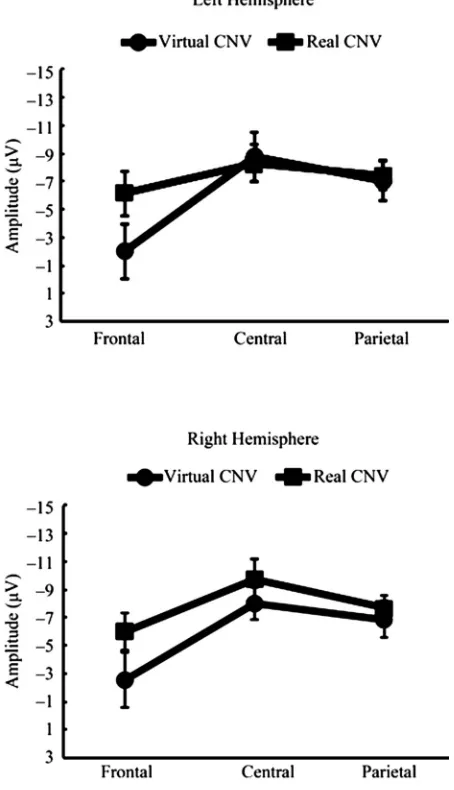 Table 1. Summary of follow-up ANOVAs for the interaction of CNV type × Electrode × Window on the mean CNV ampli-tudes from 501 ms to 3000 ms after the warning stimulus