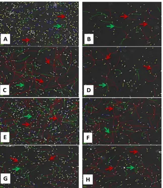 Figure 3. The class distribution of sperm cells according to their average speed showing the 