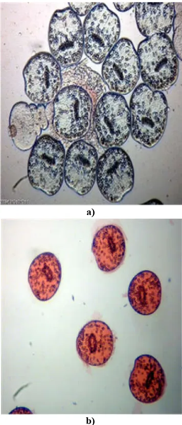 Figure 1. A live protoscolices (A);  Dead protoscolices (B) after                             exposure to ethanolic extracts and staining with 0.1% eosin 