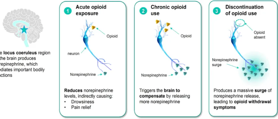 Figure 1. Pictorial representation of the effect of acute and prolonged opioid exposure on norepinephrine in the locus cœruleus