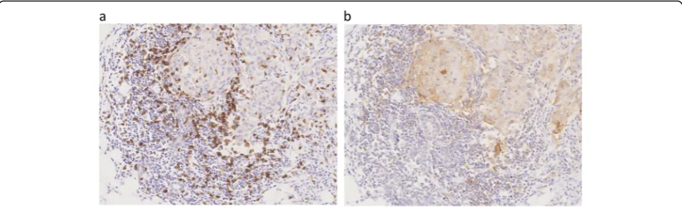 Fig. 4 Immunohistochemistry for cluster of differentiation 8 and programmed cell death ligand 1