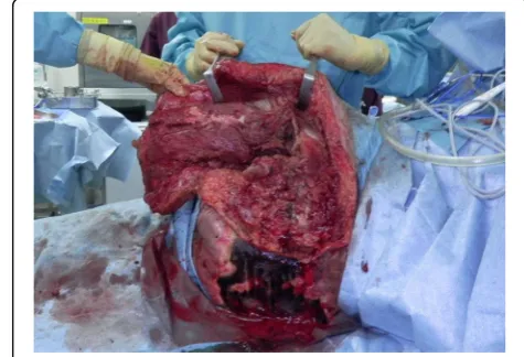 Fig. 1 Before the debridement