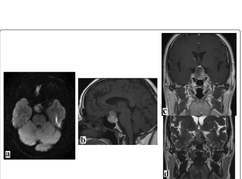 Fig. 2 Same patient as in Fig. 1. Follow-up magnetic resonance imaging 3 months after the treatment showed a very sizable reduction of the pituitaryabscess with disappearance of the peripheral edema and the local compression effect