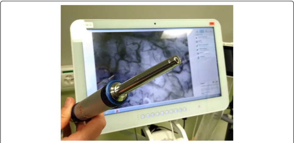 Fig. 1 CytoCam device at our intensive care unit