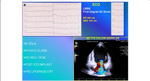 Fig. 1 acardiomyopathy,ECG Twelve-lead electrocardiogram showing the wide native QRS complex (145 ms) with first-degree atrioventricular block (PR 280 ms).b Two-dimensional color transthoracic echocardiogram apical four-chamber view