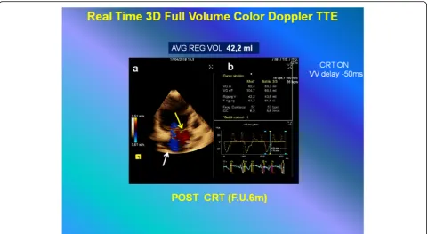Table 1 Profile three-dimensional full-volume Color Doppler of echocardiographic results