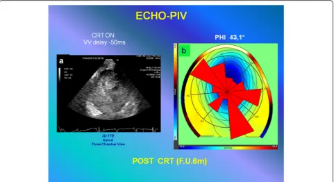 Fig. 7 Quantitative analysis (to compare with the results of analysis represented in Fig.therapy,echocardiography is performed by three-chamber apical view approach (see Additional file 10: Video S10 interventricularSONOVUE 6-month follow-up).forces that w