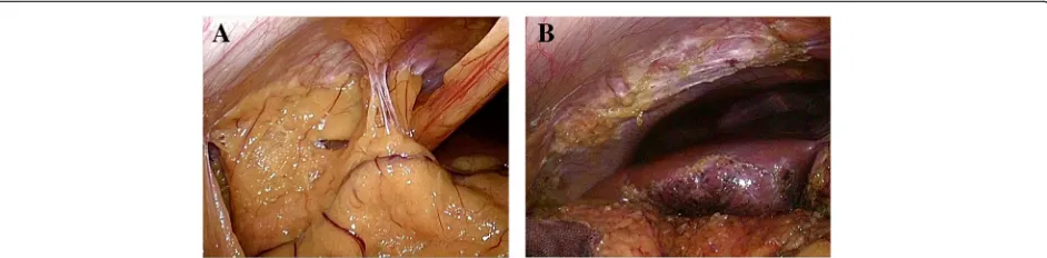 Fig. 4 Adhesion was observed between the peritoneum and greater omentum, liver, and ascending colon (a)