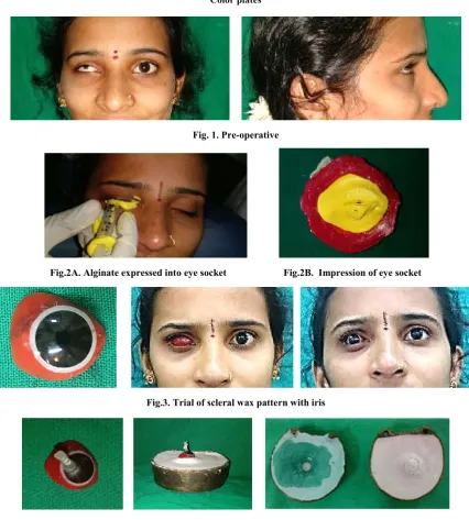 Fig. 1. Pre-operative  