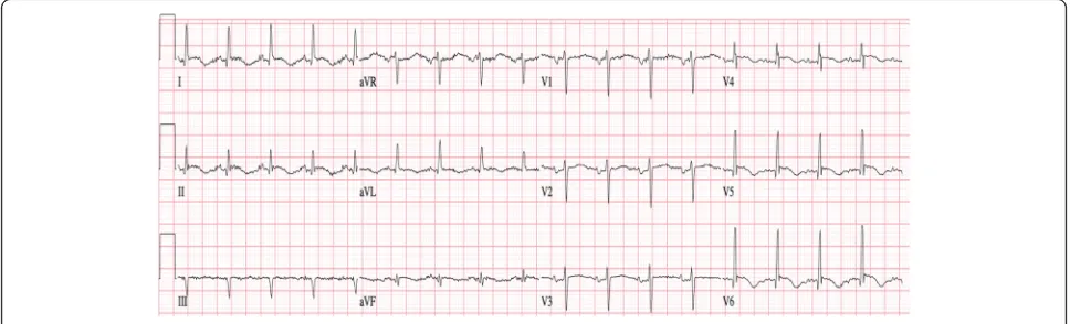 Fig. 2 Transthoracic echocardiogram revealing apical hypokinesis