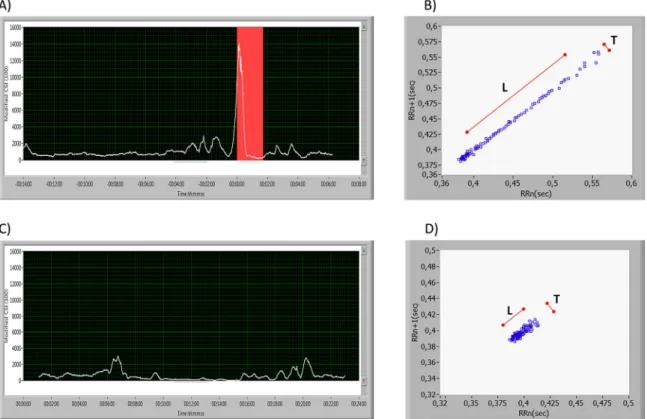 Fig. 3. Number of patients where all seizures had positive detection for the CSI, Modiﬁed CSI and HR-diff methods.