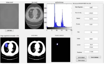 Figure 7: Abnormal lung. 