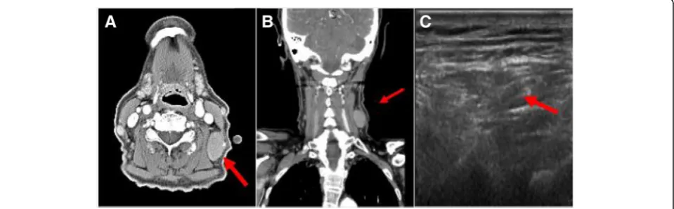 Fig. 1 Initial neck computed tomography for cervical mass and follow-up neck ultrasound