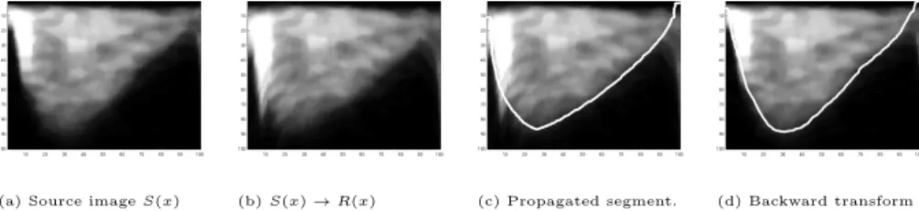 Figure 5: The segmentation procedure: Each image represents one step described in Section 4.3