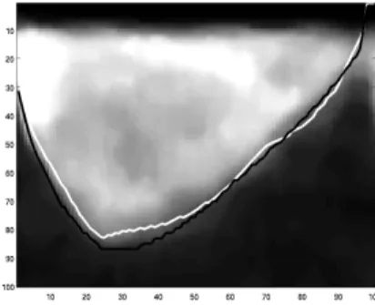 Figure 7: The comparison of manual (black) and propagated (white) segmentation. Both axes are in pixels.
