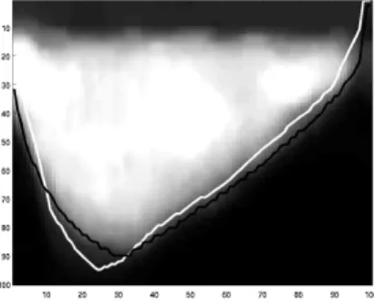 Figure 9: Propagated segmentation with larger deviation of automated segmentation (white) from the manual segmentation (black)
