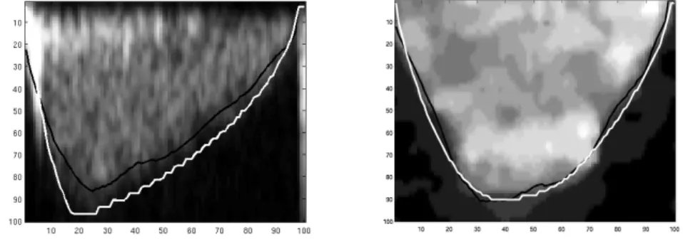 Figure 11: The comparison of manual (white) and propagated (black) segmentation for pa- pa-tients with diagnosed CAD (left) and AS (right)