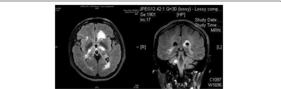 Fig. 2 Magnetic resonance imaging of the brain with contrast performed on 13 September 2013