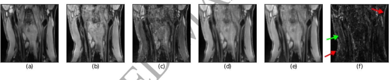 Figure 7: (a) CT image, (b) MR-T1 image and (c) MR-T2 image used in the Head&amp;Neck experiment.
