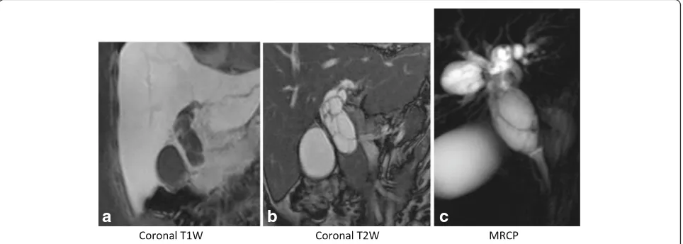 Fig. 2 Endoscopic ultrasound shows a thin-walled, multiseptated cystic lesion in the common hepatic duct and anechoic content intracystic fluidwithout mural nodules or papillary projections
