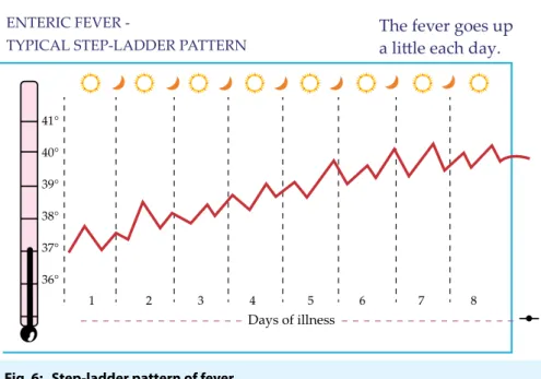 Fig. 6:   Step-ladder pattern of feverENTERIC FEVER 