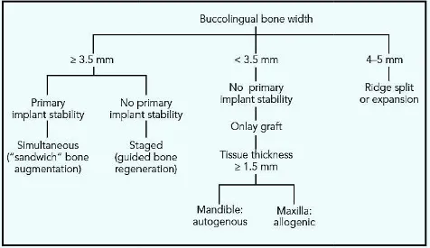 Figure 1.  Horizontal bone augmentation – The Decision Tree 
