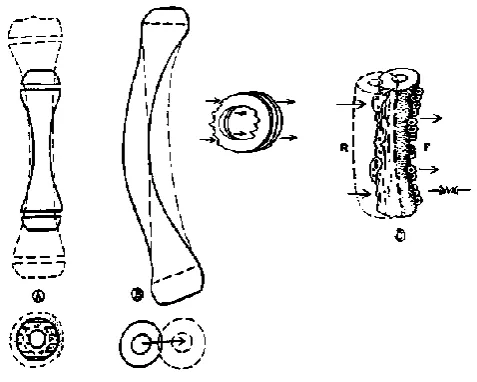 Figure 5. Wolffes law of bone transformationWolffes law of bone transformation 