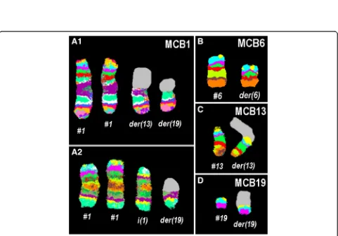 Fig. 1 GTG-banding revealed the following karyotype in 6/18 metaphases: 46,XY,del(6)(q?),der(13)t(1;13),der(19)t(1;19)[6]