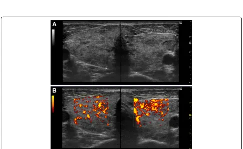 Fig. 1 Clinical course of the patient. The reference ranges for body weight, serum levels of free triiodothyronine, free thyroxine, and thyroid-stimulatinghormone; and titers from the first-generation, second-generation, and third-generation thyroid-stimul
