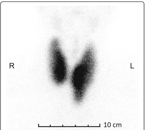 Fig. 3 Thyroid scintigraphy (July 2013). Technetium-99 m sodiumpertechnetate thyroid scan (anterior view) showing a diffuseaccumulation in the thyroid gland with an increased thyroiduptake rate of 14.2% (reference range 0.5 to 4.0%)