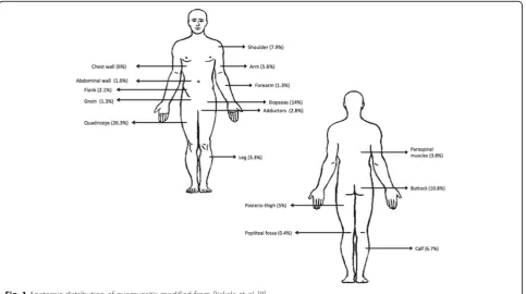 Fig. 1 Anatomic distribution of pyomyositis modified from Bickels et al. [8]