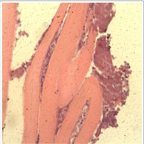 Figure 4 Histopathologic specimen.