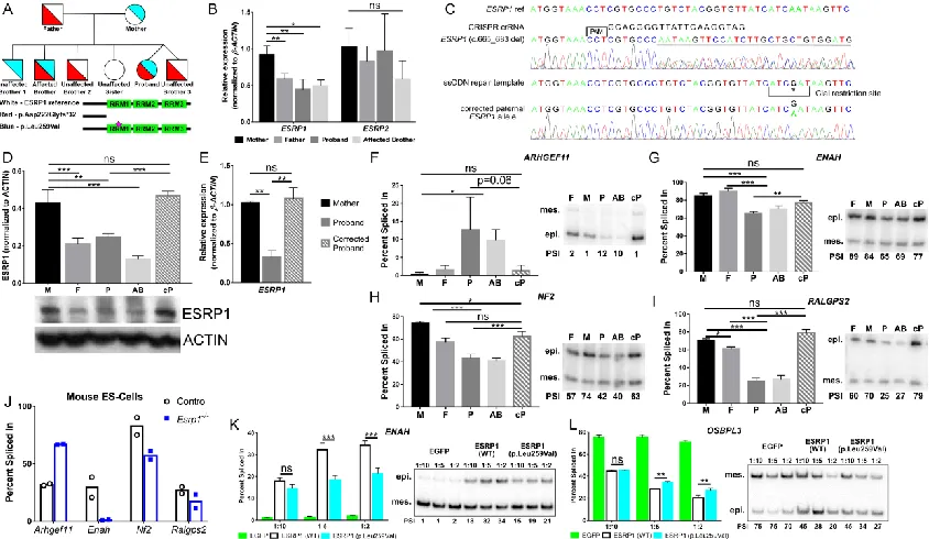 Figure 2.2. ESRP1 mutations segregate with SNHL and disrupt alternative splicing.  