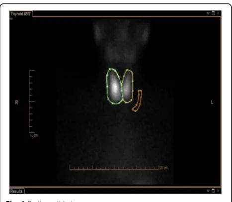 Fig. 1 Radionuclide images