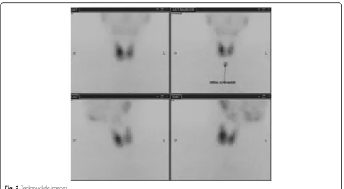 Fig. 2 Radionuclide images