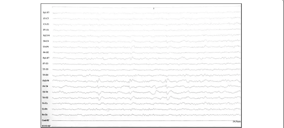 Fig. 1 Abnormal electroencephalogram obtained 2 years before the death of the patient