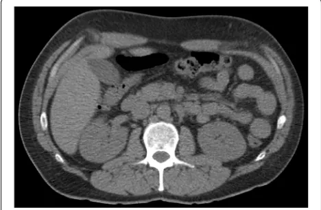 Fig. 1 A helical computed tomography scan performed during thefirst emergency department visit showing no sign of urolithiasis.The kidneys are normal