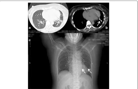 Fig. 3 The patient’s cerebral computed tomographic scans. a Scan taken 9 days after the patient’s unconsciousness