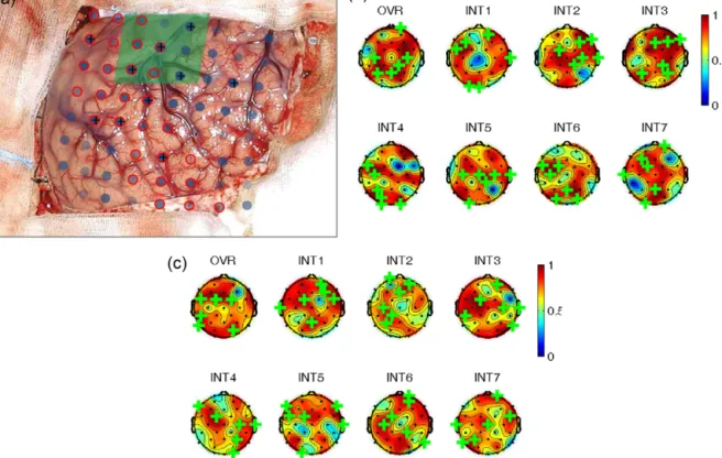 Fig. 5. Appearance percentage (AP) for case 1 (a), case 2A (b), and case 2B (c). In (a), dots are electrodes and the face colour transparency indicates AP – more solid colour means higher value, top 10 ranked channels are marked with ‘+’; red circles mark 
