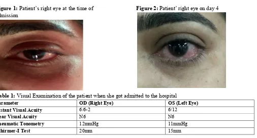 Figure 2: Patient’ right eye on day 4 