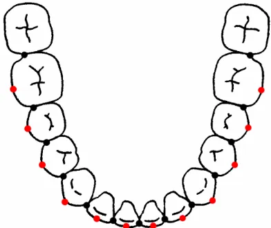 Figure 2. The superimposition of mandibular arch forms.  
