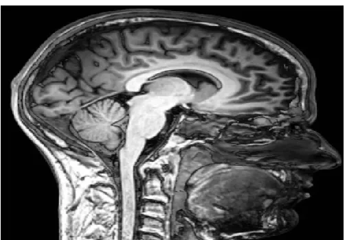 Fig. 4. MRI Scan of Normal Human Brain 