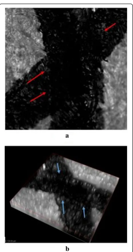 Fig. 5 Black Cello Pinpoint pen intersecting strokes. a 2D figure. b3D figure