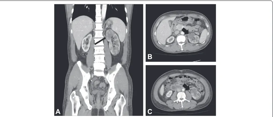 Fig. 3 Abdominal and lower extremity angiography (2014). a Renal angiography could not identify either renal artery due to total occlusion