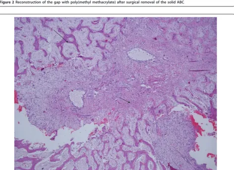 Figure 2 Reconstruction of the gap with poly(methyl methacrylate) after surgical removal of the solid ABC.